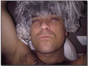 Robbie with a dog on his head